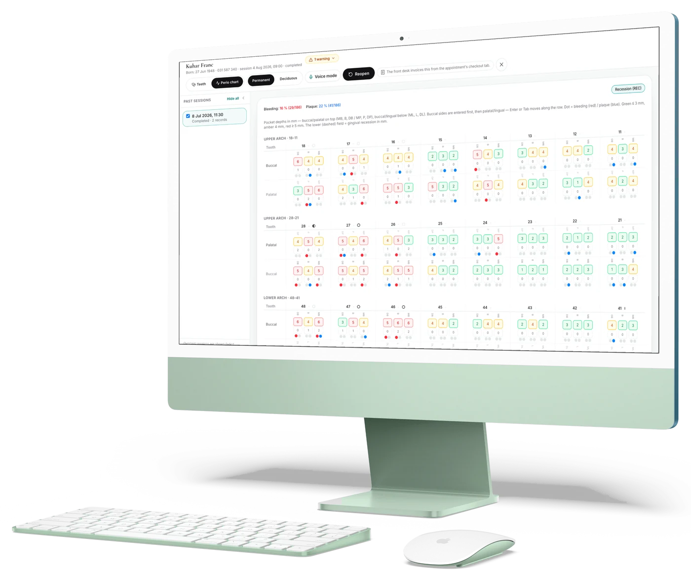Ordion Dental perio chart with voice mode on an iMac in the dental green.