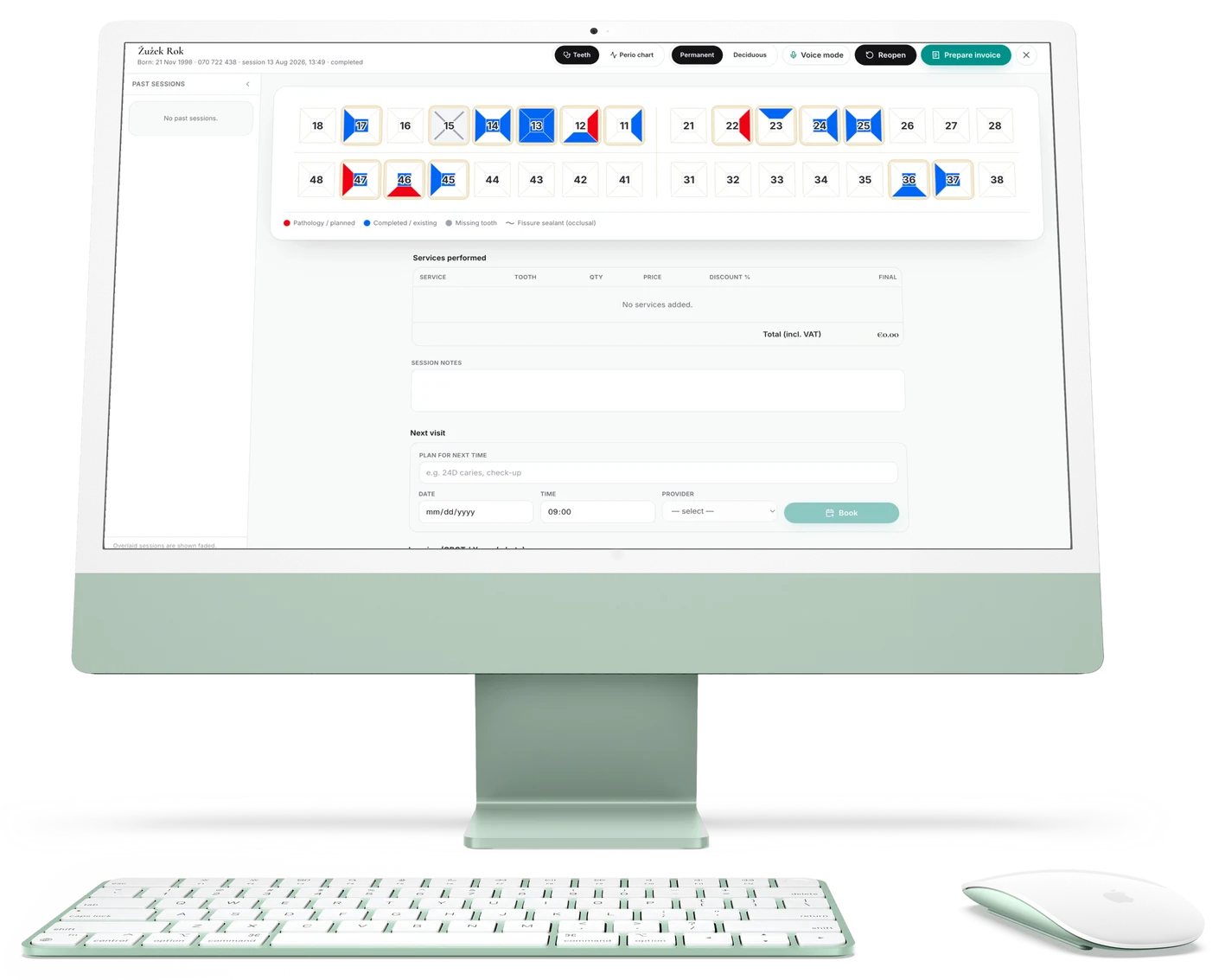 Odontogram session view with services performed and invoice preparation.
